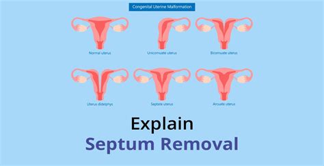 double vagins|Vaginal Septum: What You Need to Know .